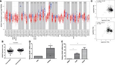 ACAA1 Is a Predictive Factor of Survival and Is Correlated With T Cell Infiltration in Non-Small Cell Lung Cancer